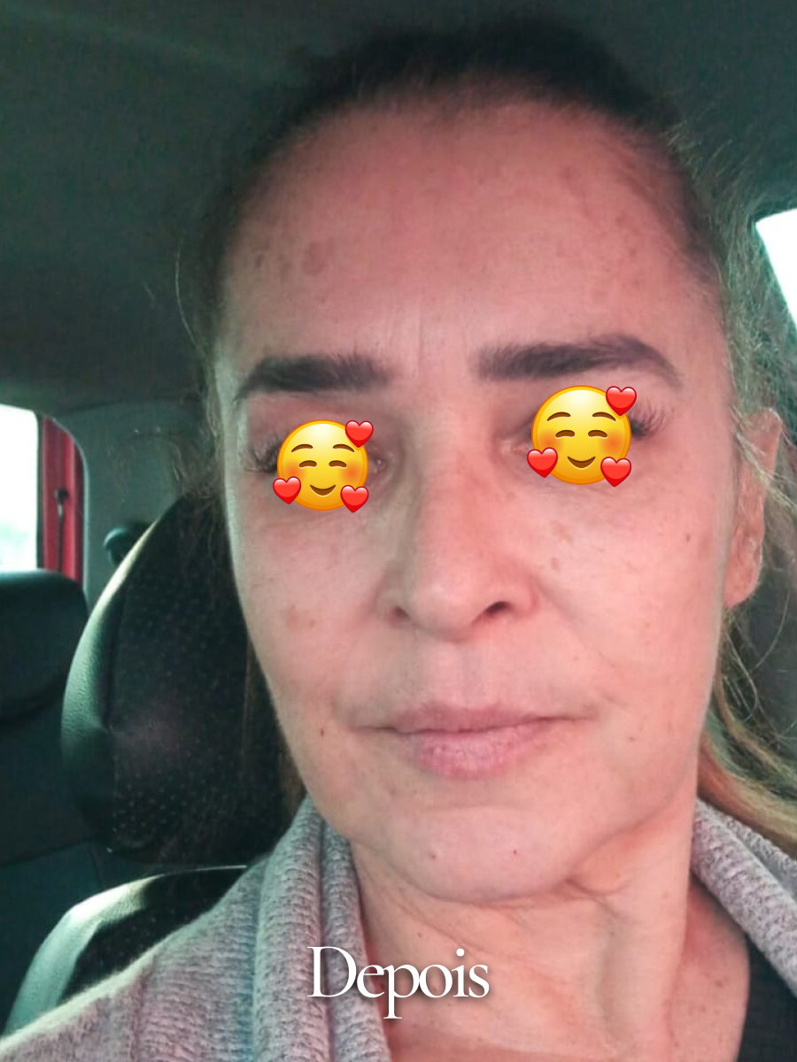 Depois do procedimento 14