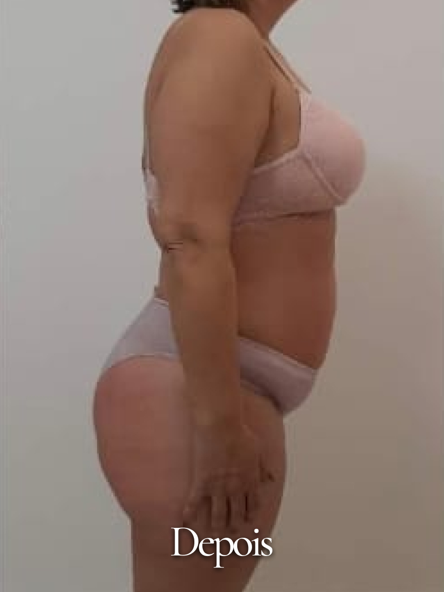 Depois do procedimento 27